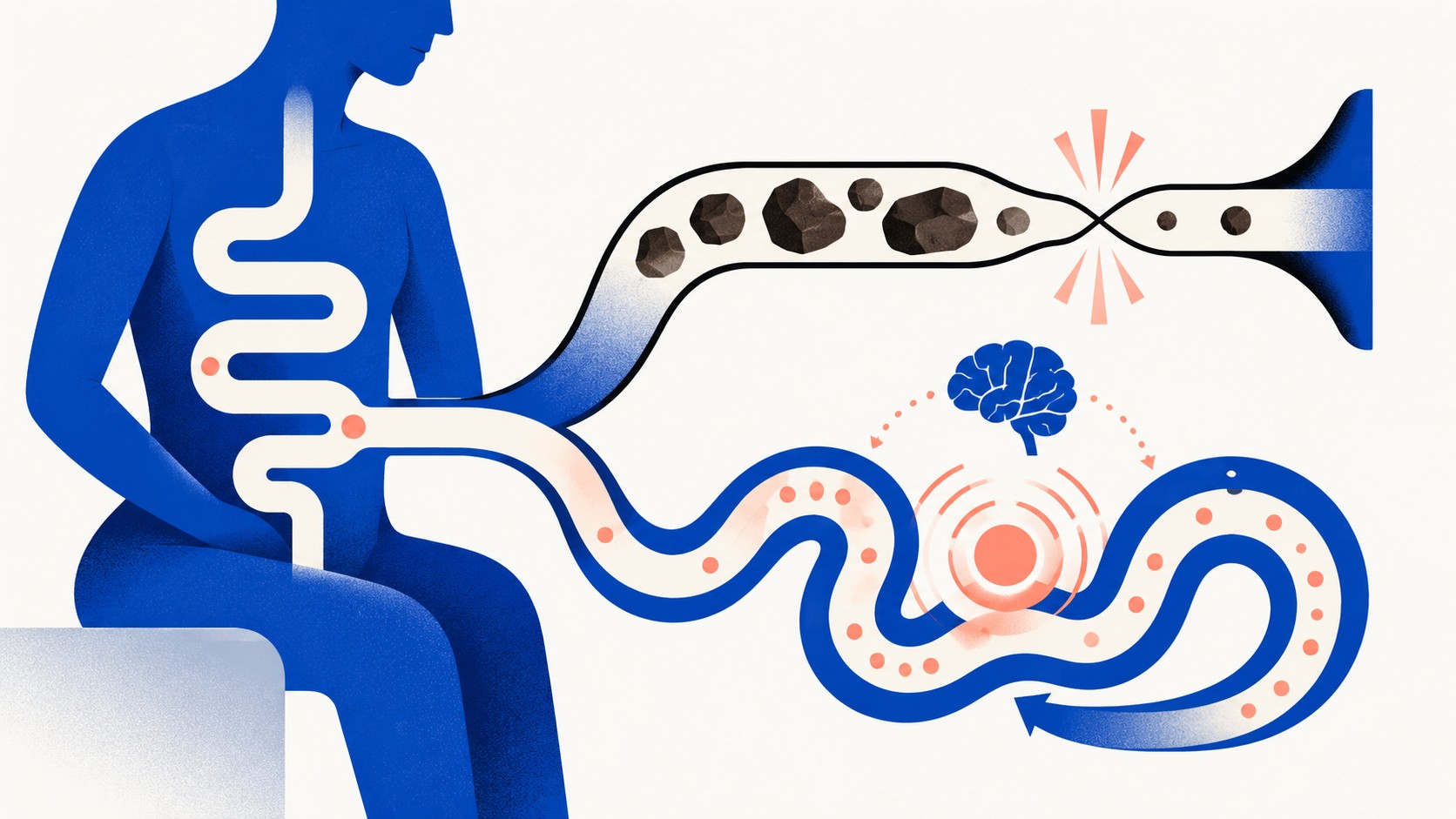 배출구에서 좁아지는 변비 경로와 통증 파동이 도는 IBS-C 경로를 나눈 추상 일러스트